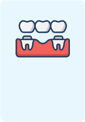 Reconstruim zâmbete sănătoase folosind materiale și tehnici moderne pentru proteze fixe sau mobile
